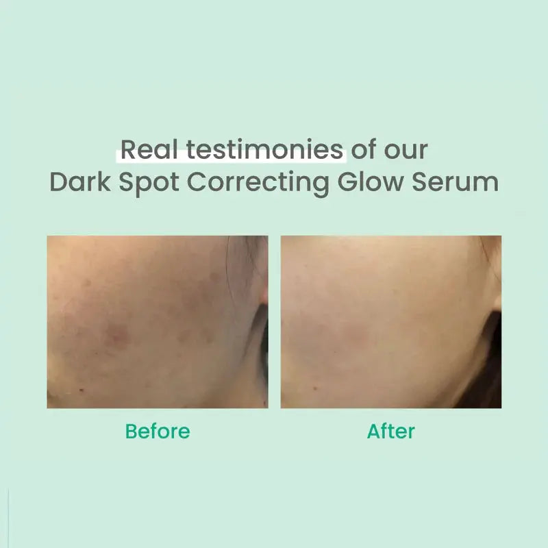 AXIS-Y Dark Spot Correcting Glow Serum 5 ml