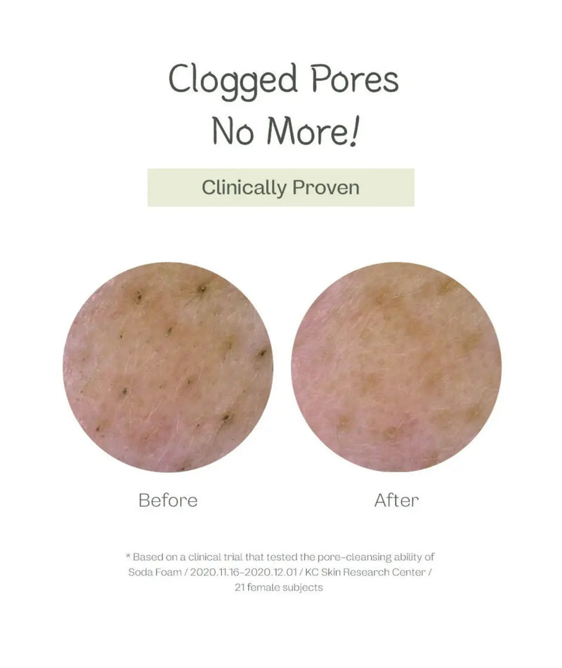Manyo Deep Pore Cleansing Soda Foam